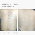 어텀에스테틱 안양본점
