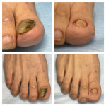 푸스케어 성수뚝섬점