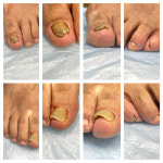 푸스케어 성수뚝섬점