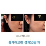 이조은에스테틱 진주혁신점