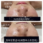이조은에스테틱 진주혁신점