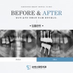 순천스마트치과의원