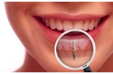 내곡웰치과의원