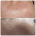 라쉼뷰티테라피