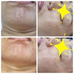 라쉼뷰티테라피