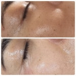 라쉼뷰티테라피