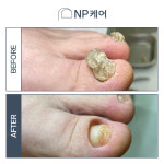 엔피케어 부산센텀점
