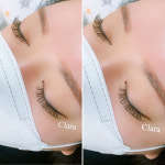 클라라뷰티라인