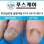 푸스케어 남포점 글림네일