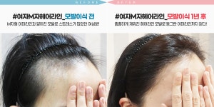 드림헤어라인의원