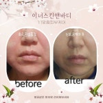 이너스킨앤바디