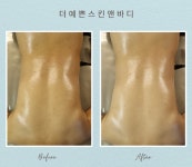 더예쁜스킨앤바디