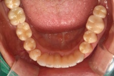 서울탑플란트치과의원