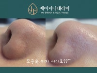 제이지니테라피