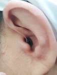 울산독일보청기 공업탑센터
