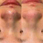 하베레피부전문센터