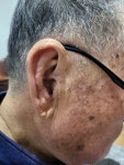 시그니아독일보청기 동래센터