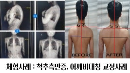 춘천 바디앤라이프 필라테스 & PT