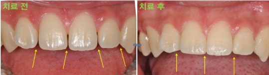 케이치과기공소