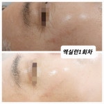 라인메이드스킨케어