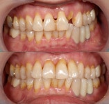 케이치과기공소