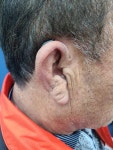 벨톤보청기 이천지사