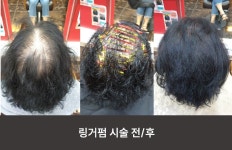 동국대승지헤어 | 카라헤어