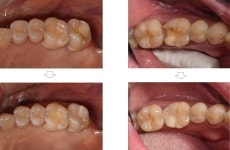이엔지치과기공소