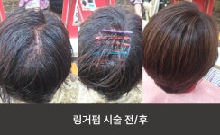 동국대승지헤어 | 카라헤어