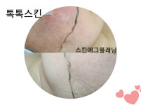 톡톡스킨 고양시본점