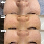 하베레피부전문센터