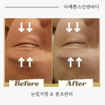 더예쁜스킨앤바디