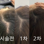 샬롱드에뜨왈