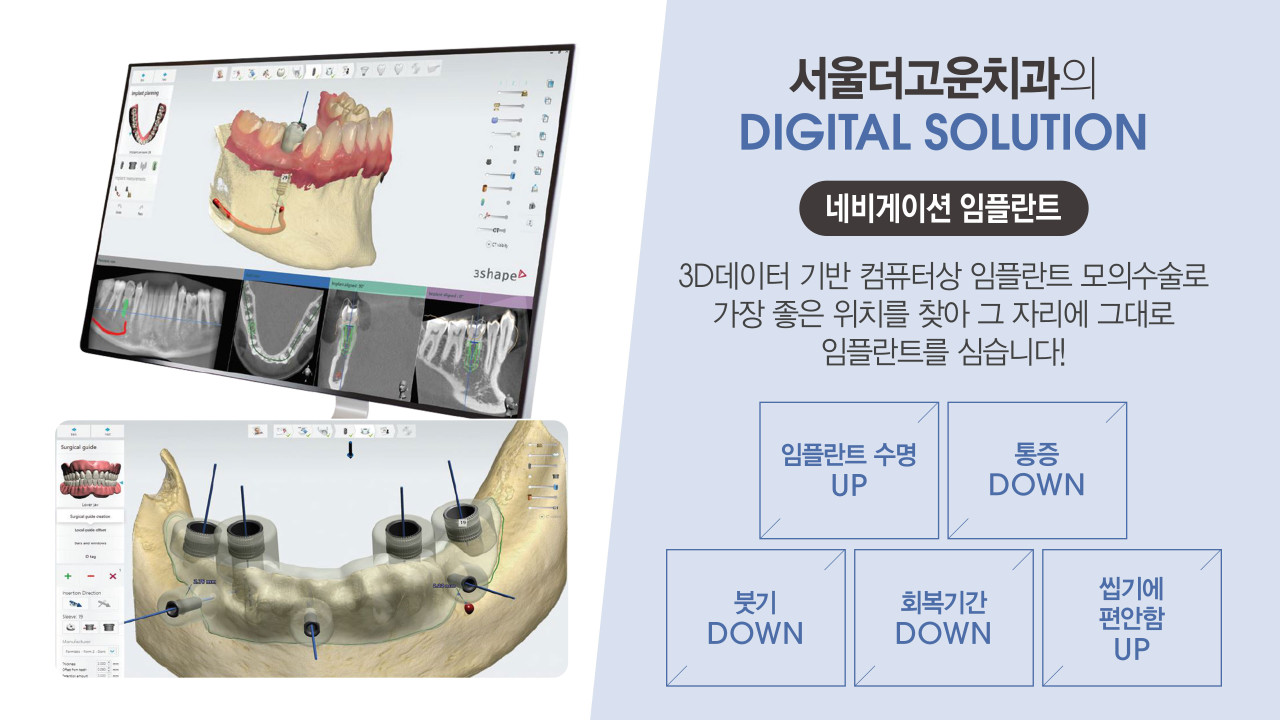 서울더고운치과의원 미사본점 광고