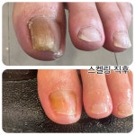 굳네일(GoodNail) | 굳네일