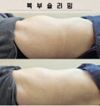 스무살에머물다 진서네일