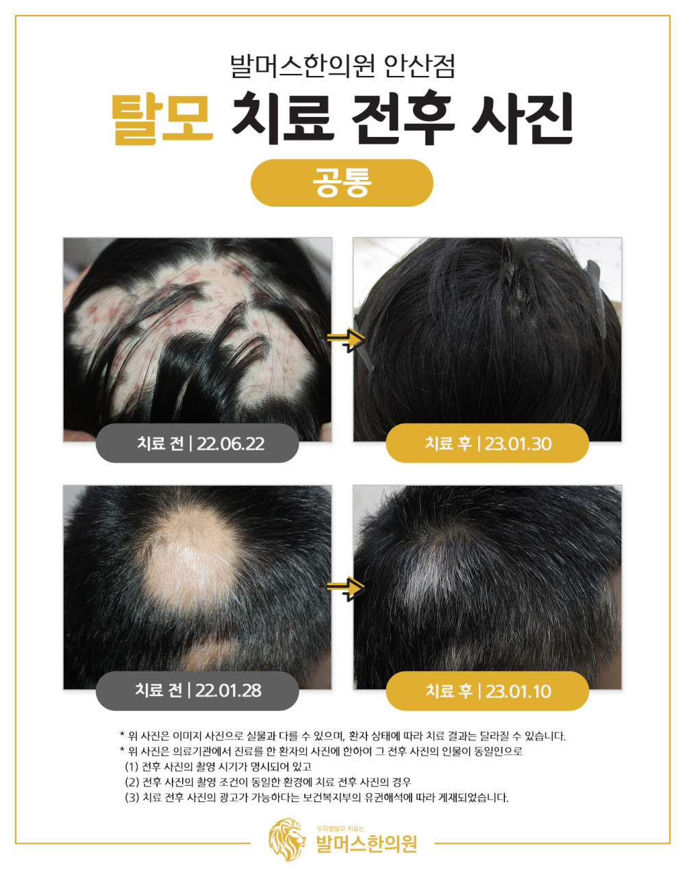 발머스한의원 안산