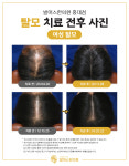 발머스한의원 일산
