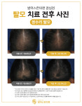 발머스한의원 잠실