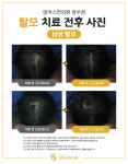 발머스한의원 광주