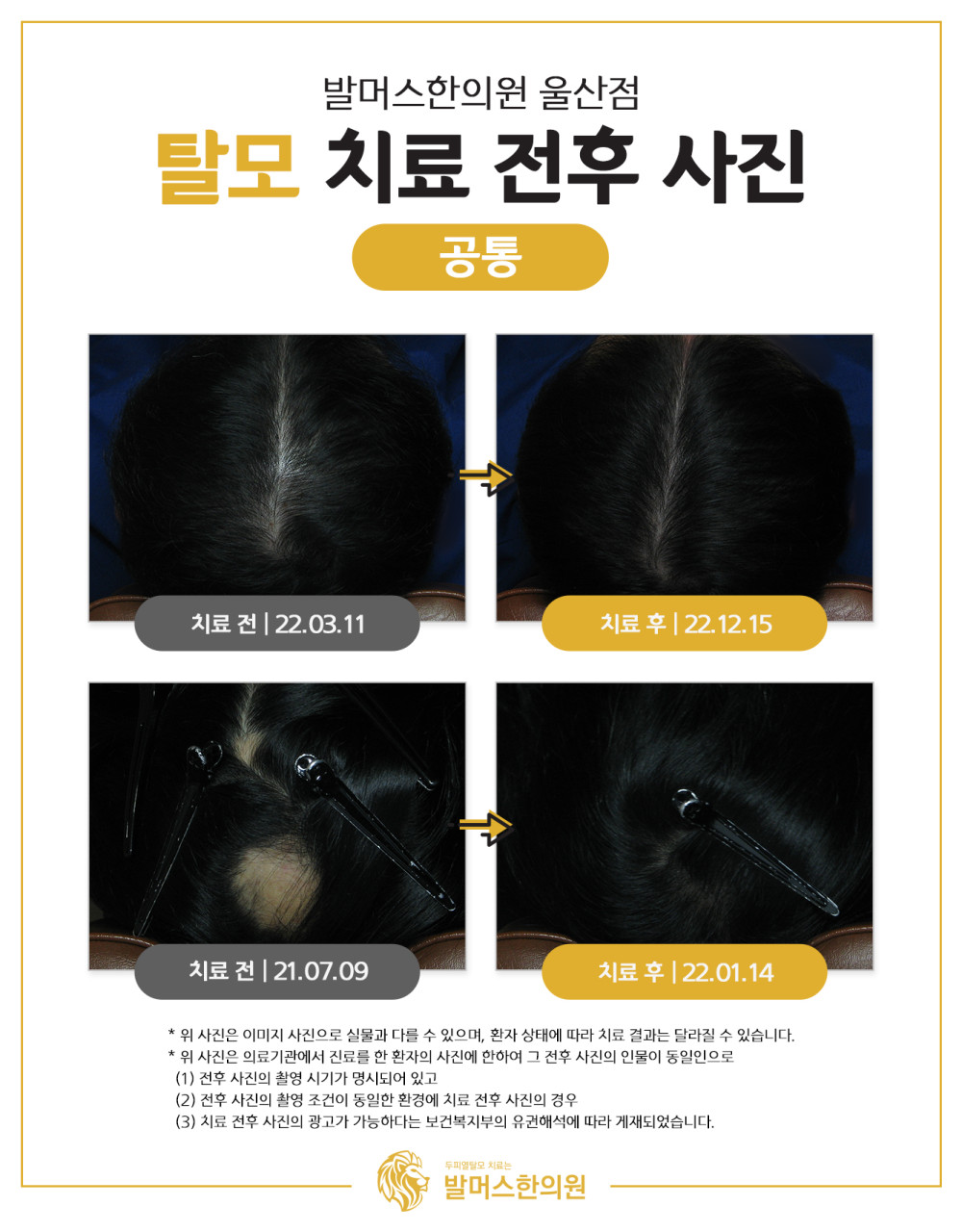 발머스한의원 울산