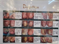 디에고푸스 희네일 이촌점