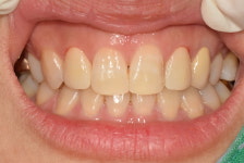 디라이트치과기공소