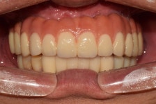 디라이트치과기공소