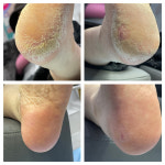 푸스케어 성수뚝섬점