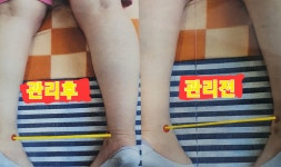 주약손체형교정명가