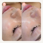 더맑은스킨 평택고덕점