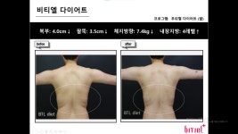 비티엘플러스