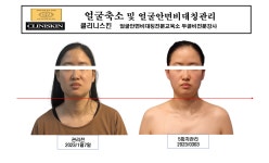 바른얼굴 정안