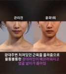 작은얼굴바른체형